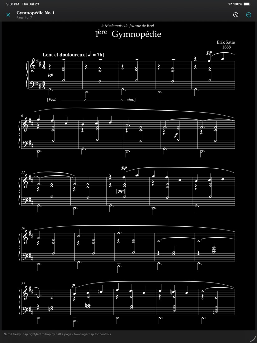 A score page inverted to white notation on a black ground.